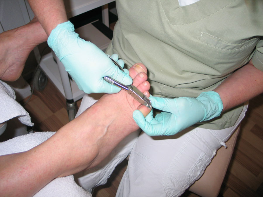 Fodbehandling hos FeetCare